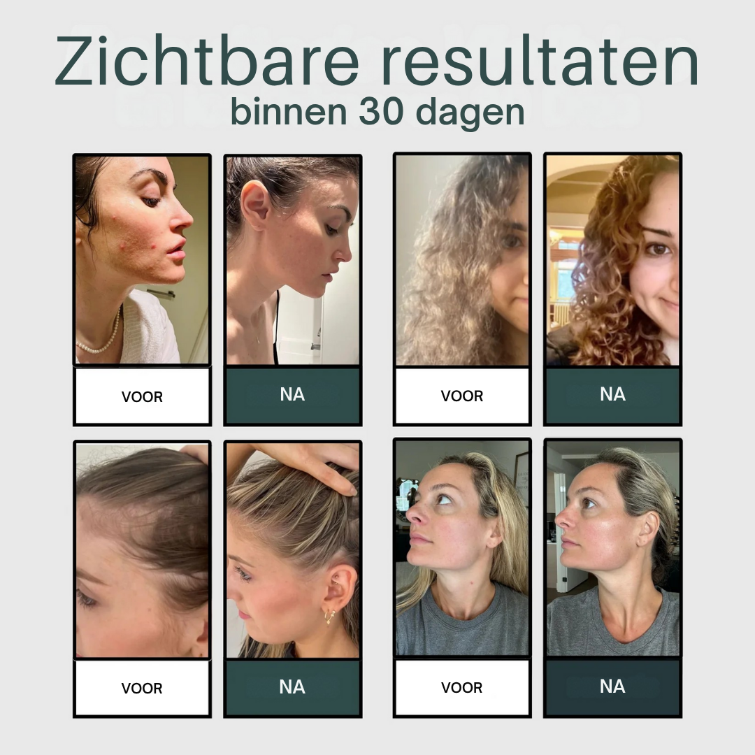 Pommeau de douche filtrant AQUAÉLLE – Eau pure, peau éclatante et cheveux sains | + 5 filtres GRATUITS