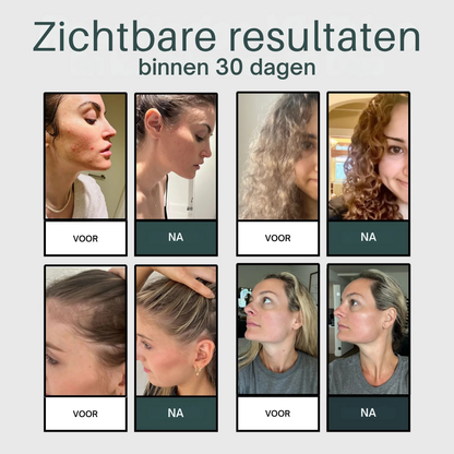 Pommeau de douche filtrant AQUAÉLLE – Eau pure, peau éclatante et cheveux sains | + 5 filtres GRATUITS
